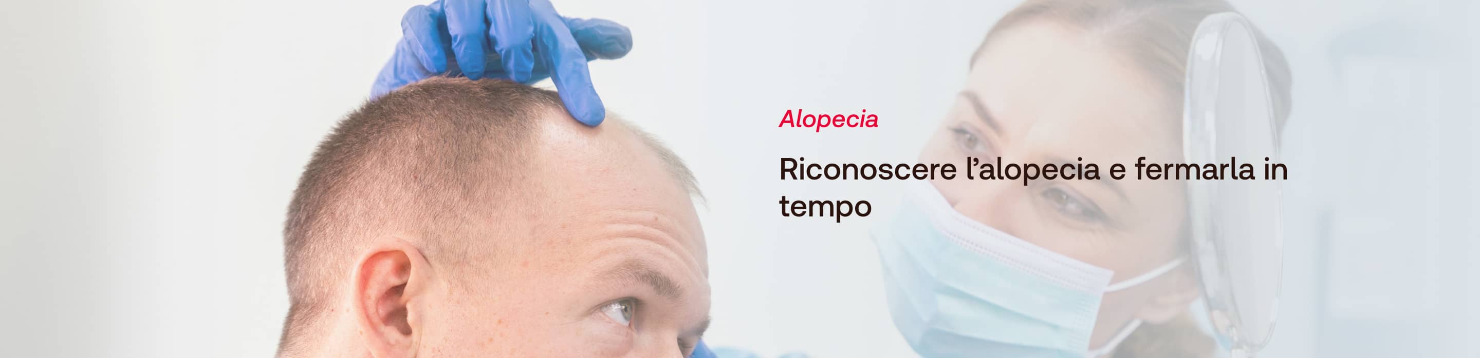 Alopecia - GUIDA