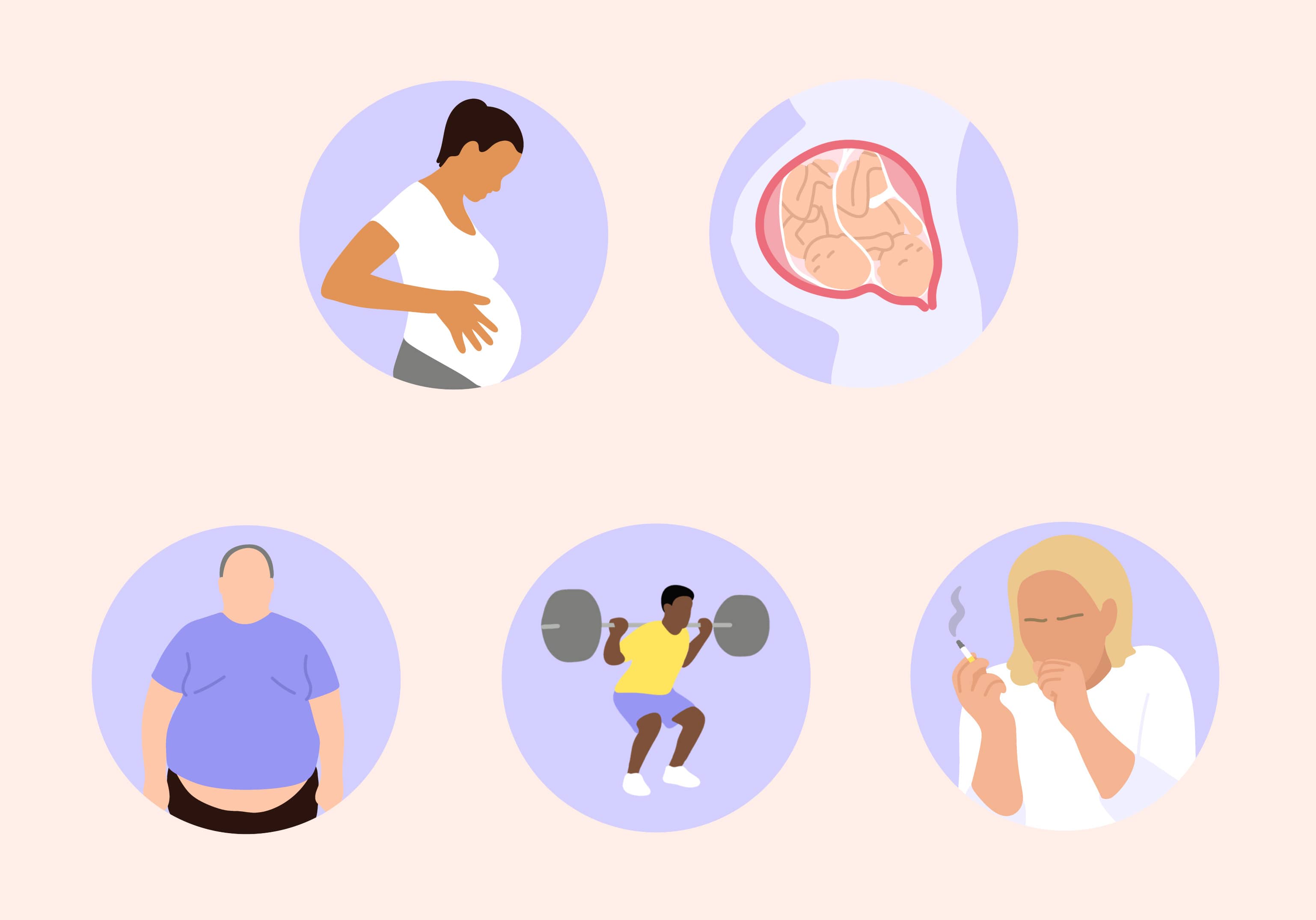 diastasi addominale cause