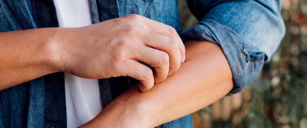 Trattare e riconoscere precocemente i funghi della pelle