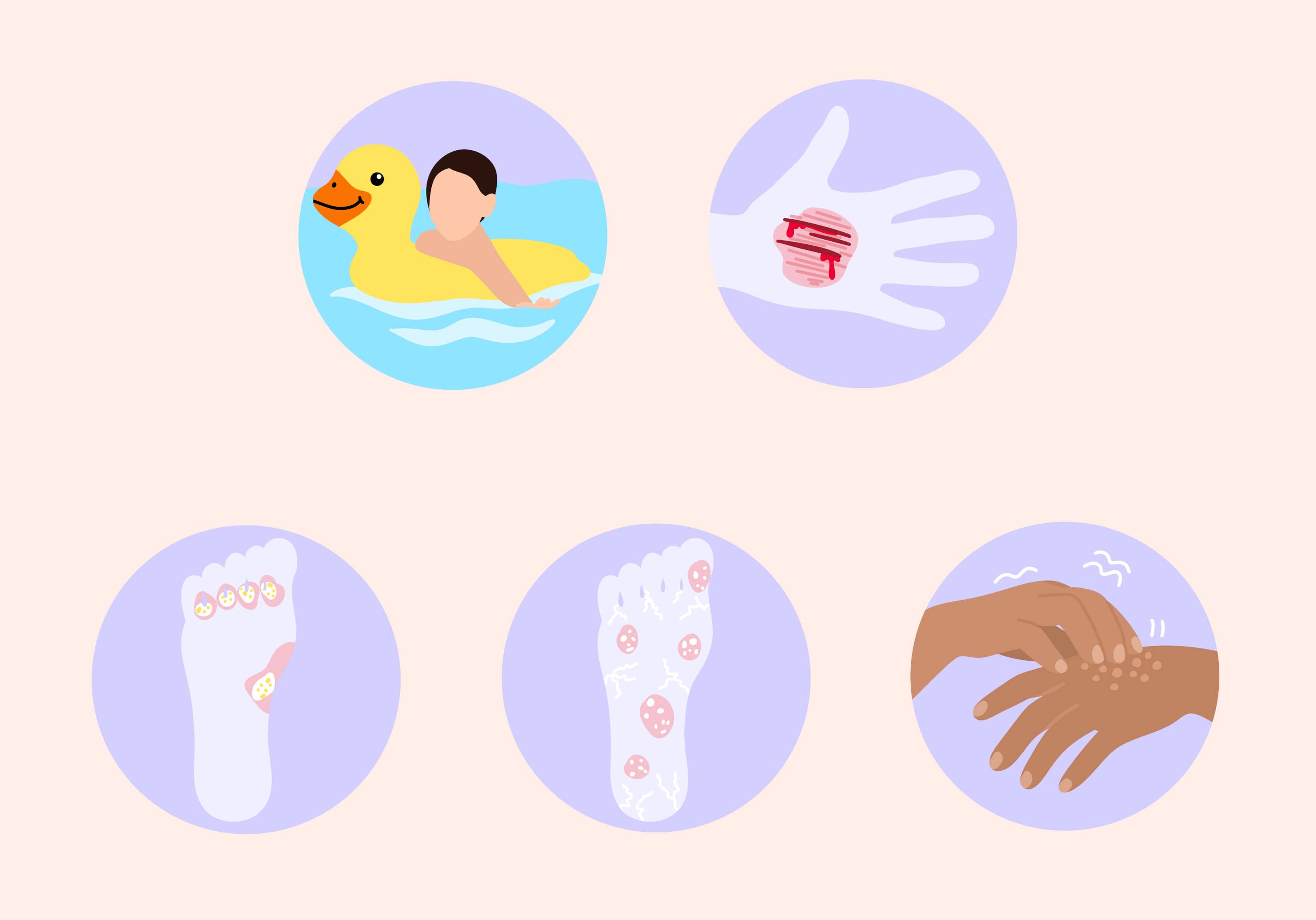 mollusco-contagioso causa