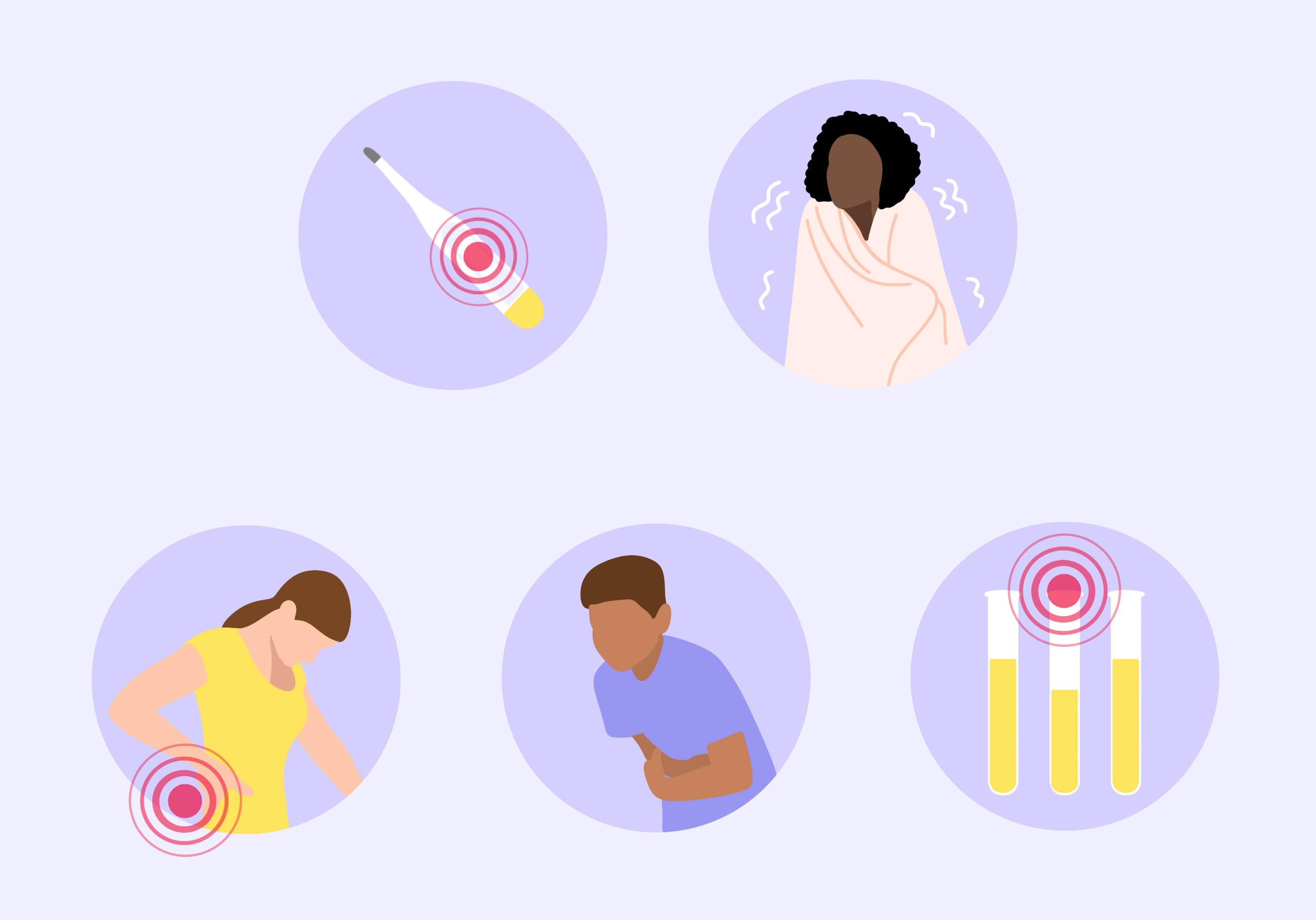 pielonefrite sintomi