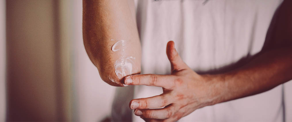 Psoriasi: cause, sintomi e trattamento