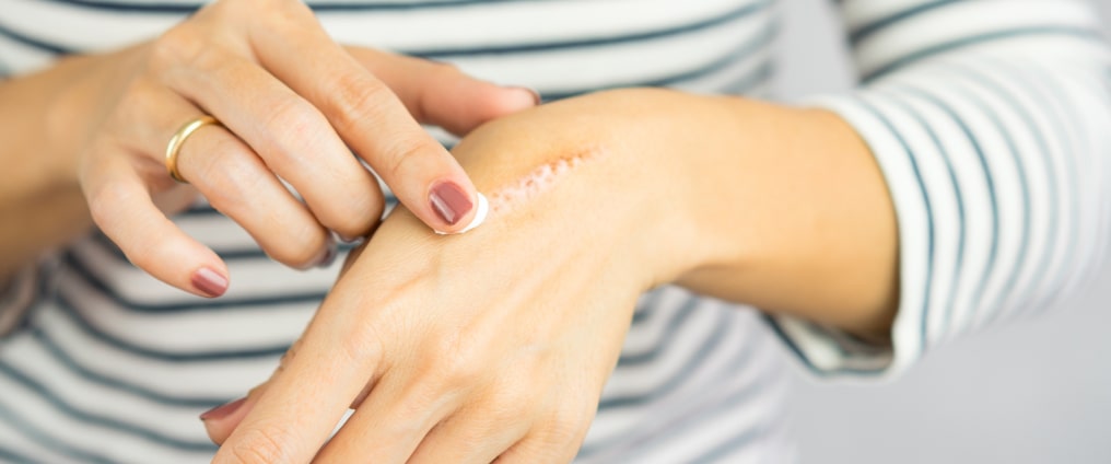 Trattamento delle cicatrici - come curare la pelle danneggiata?