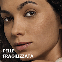 Avène – Pelle fragilizzata